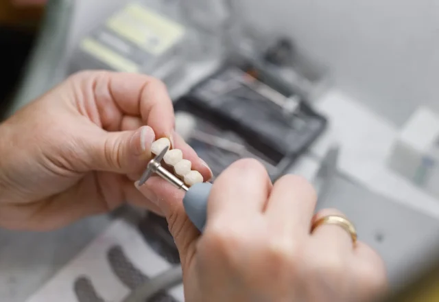 04-Crowns & Bridges 1