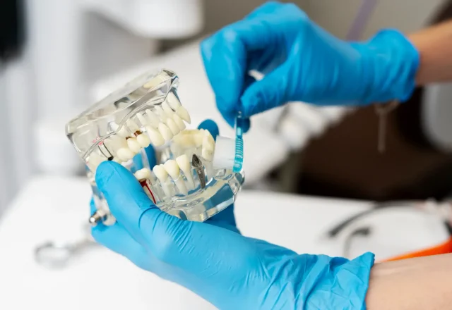 06-Dental Implants 1