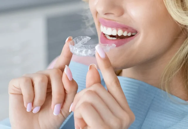 13-Invisalign1 1