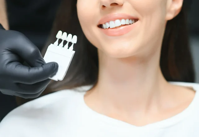 dentist-checking-and-selecting-color-of-young-woma-2026-03-23-23-32-34-utc