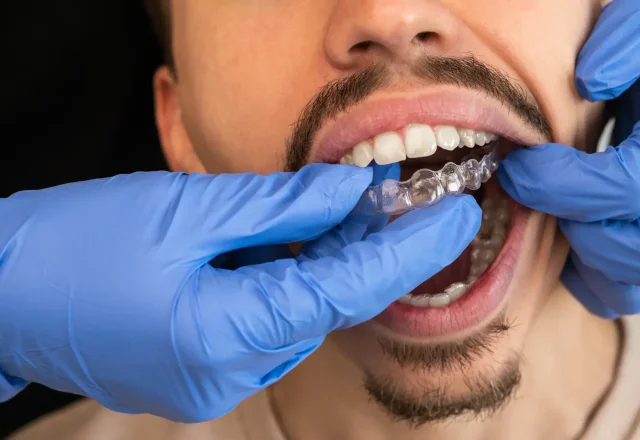 man-dentist-applying-invisible-aligner-on-male-pat-2026-03-16-02-09-37-utc 1